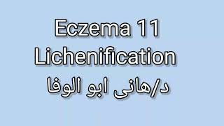 11 Lichenification by Dr Hany Abo Elwafa [upl. by Nedroj]