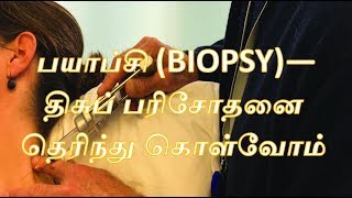 பயாப்சி BIOPSYதிசுப் பரிசோதனை தெரிந்து கொள்வோம்  English Subtitlecancer [upl. by Nwahsor]