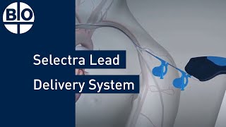 Enhancing CRT with Selectra Lead Delivery System [upl. by Karena]