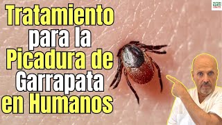 🚨 PICADURA DE GARRAPATA EN HUMANOS TRATAMIENTO MÁS EFECTIVO 🚨 [upl. by Nnylsaj11]