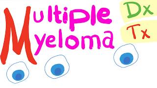 Multiple Myeloma Diagnosis and Treatment [upl. by Ineslta]