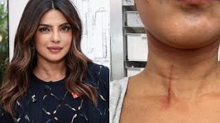 Priyanka Chopra Shares Image of Neck Cut Suffered Doing Stunts on New Movie ‘Hazards on My Jobs’ [upl. by Hambley]