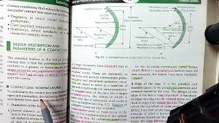 Contact Lens Designs amp Parameters  AK Khurana  Dr Saud Javed [upl. by Dennison75]