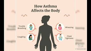 Severe Asthmatic attack symptoms Asthmatic symptoms Health talk November 10 2024 [upl. by January]