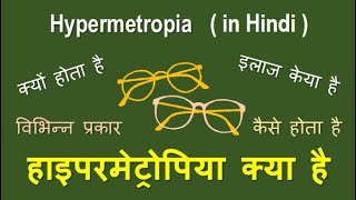 Hypermetropia causes types and treatment in Hindihypermetropia hyperopia longsightedness [upl. by Starinsky]