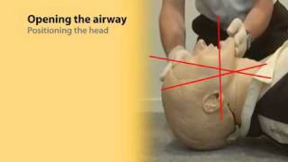 Basic Airway Management 1 [upl. by Squire871]