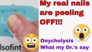 My Nails Are Falling Off 😱😱😱 Onycholysis What My Doctor Told Me To Do [upl. by Sitnik]