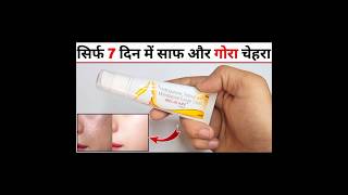 Melacare Cream Review in Hindi मेलाकेयर क्रीम के फायदे नुकसान उपयोग [upl. by Dode]