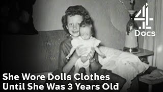 Meet a Woman Who Wore Dolls Clothes Until She Was 3YearsOld [upl. by Cordelie]