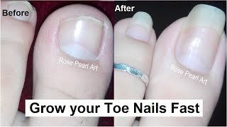 HOW TO CUT THICK TOENAILS  Toenail Cleaning Satisfying 22 [upl. by Araek]