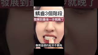 缺牙福音 再生矽牙膏專攻蛀牙 牙洞 [upl. by Ttnerb]