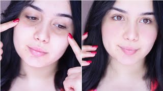 طريقة التخلص سريعا من الهالات السوداء طبيعيا  Bye Bye Dark Circles [upl. by Tebasile]