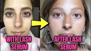 WHAT HAPPENS AFTER LASH SERUM IM HERE TO TELL YOU Before amp After Results [upl. by Audun761]