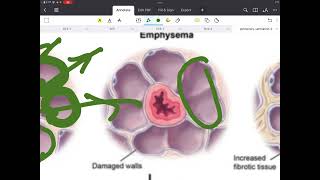 Respiratoryphysiology 2 [upl. by Savinirs]