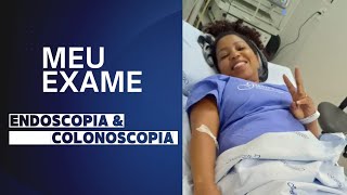 MEU EXAME ENDOSCOPIA ampCOLONOSCOPIA [upl. by Kathie955]