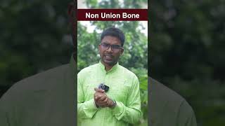 Non Union Fracture  How to Heal Non Union Fracture ayurvedadoctor fracture nonunionfracture [upl. by Dill903]