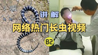 4K  网络热门长虫视频82年仅13岁男孩网购银环蛇当宠物？刚买来就被咬进ICU险些丧命！【世界记忆大师龙雅】 [upl. by Morentz]