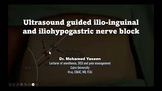 Ultrasound guided ilioinguinal and iliohypogastric nerve block [upl. by Codi]