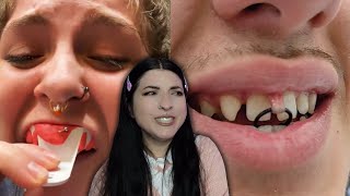 Piercer Reacts To The WEIRDEST Piercing Fails [upl. by Odrahcir]