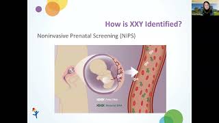 Susan Howell  Understanding XXY 2023 [upl. by Shamus]