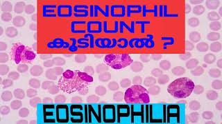 Eosinophilia  Absolute Eosinophil Count AEC Malayalam [upl. by Rigby]