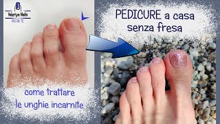 Pedicure fai da te SENZA FRESA  Come trattare la unghia incarnita a casa [upl. by Eirena]