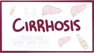 Cirrhosis  causes symptoms diagnosis treatment pathology [upl. by Jerroll]