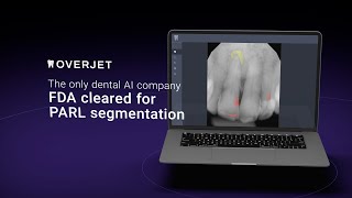 Firstofitskind FDAcleared PARL segmentation capabilities [upl. by Ocirederf150]