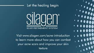 Silagen Acne Scar  Spot Corrector Introduction [upl. by Meean735]