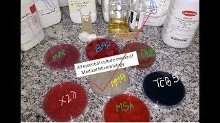 All essential culture media of Medical Microbiology Practical demo from a single table [upl. by Calvinna637]