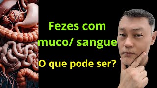 FEZES COM MUCO E OU SANGUE O QUE PODE SER [upl. by Kerk834]