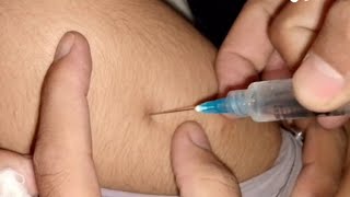 Injection lagane ka tarika  how to give intramuscular injection  nursing school Ep02 [upl. by Annatsirhc810]