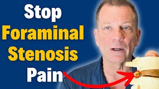 7 Steps to Beat Foraminal Stenosis Without Surgery amp Relieve Nerve Pain  Dr John Zielonka [upl. by Cassella]