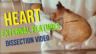 External features of the Heart Dissection video [upl. by Gareri]