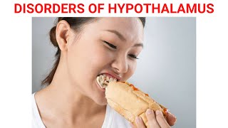 Disorders of Hypothalamus [upl. by Llerral]