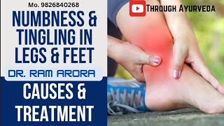 Leg Numbness Paresthesia Treatment  पैर सुन्न होना पेरेस्थेसिया  पैर सुन्न होने पर क्या करें [upl. by Wolfgang183]