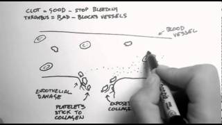 Haemostasis 1  Clots Thrombi amp Antiplatelets [upl. by Lorene96]