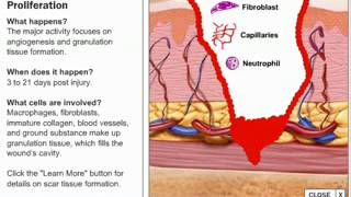 Stages of Wound Healing Process [upl. by Atiuqehc99]