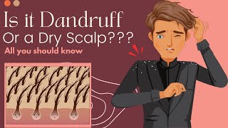 Is It Dandruff Or A Dry Scalp Heres What You Need To Know [upl. by Heda]