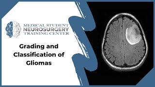 Grading and Classification of Gliomas [upl. by Ramas]