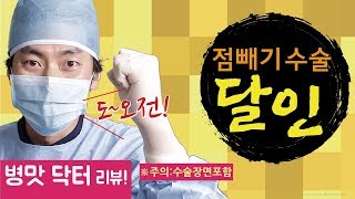 점빼기점빼는영상 폭망 점빼기후기 리뷰 [upl. by Kowal]