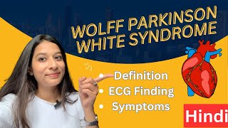 WolffParkinsonWhite WPW Syndrome in Hindi  ECG findings Diagnosis Treatment [upl. by Poul]