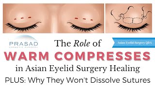 Why Warm Compresses in 2nd Phase of Eyelid Surgery Healing Wont Dissolve Sutures [upl. by Anial]