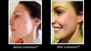 Jeunesse Instantly Ageless Live Product N1 [upl. by Sihunn263]