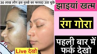 नारियल तेल में 1 gel 😊 मिलाकर झाइयों को जड़ से ख़त्म किया मैंने  Pigmentation Removal skincare [upl. by Jeremias]