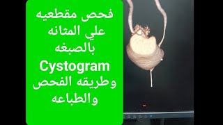 فحص Cystogram او اشعة بالصبغة علي المثانة علي جهاز مقطعيه GE [upl. by Nannie]