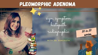 pleomorphic adenoma I oral pathology lectures [upl. by Ayekat]