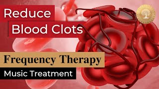 Blood Clots Bioresonance Music Therapy ๏ Rife Frequency Treatment ๏ Healing Nature Frequencies [upl. by Benni]