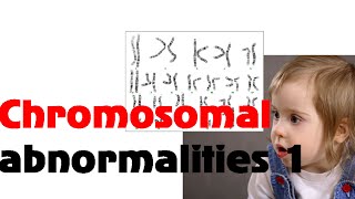 Chromosomal abnormalities 1 [upl. by Salomone510]