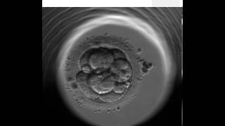 ES  continual monitoring of embryo development in Embryoscope [upl. by Ahsaek]